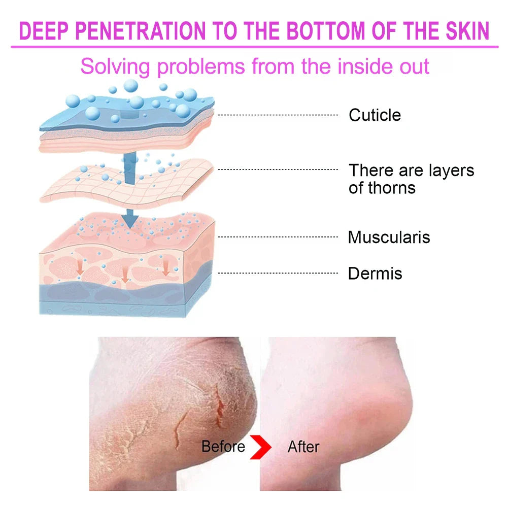 SoftStep Foot Care Kit