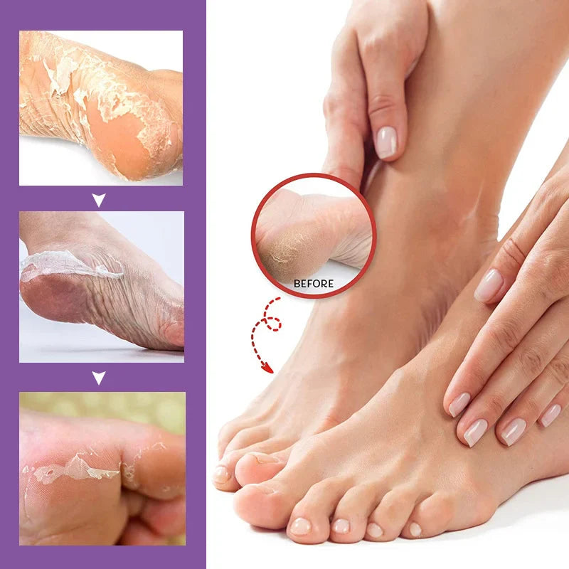 SoftStep Foot Care Kit