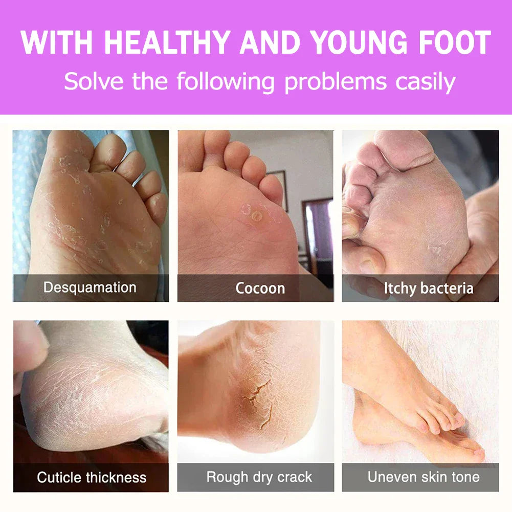 SoftStep Foot Care Kit
