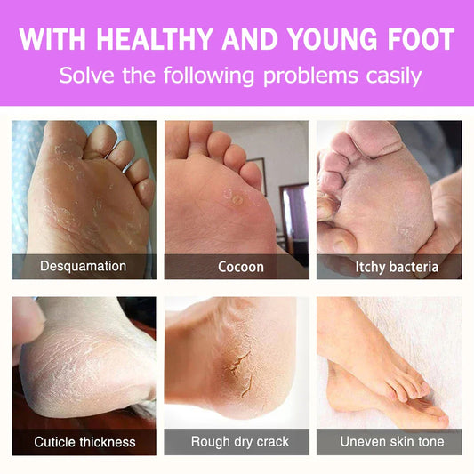 SoftStep Foot Care Kit